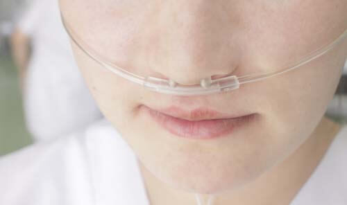 POC and CPAP Therapy